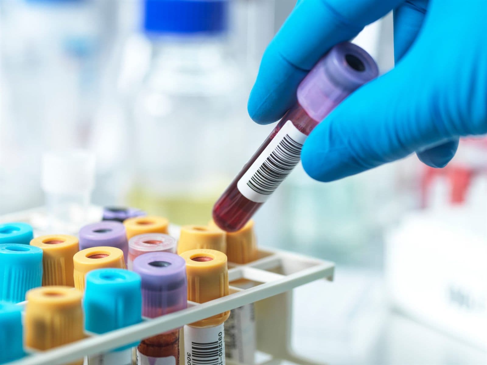 Come capire le analisi del sangue leggendo il referto per pannelli
