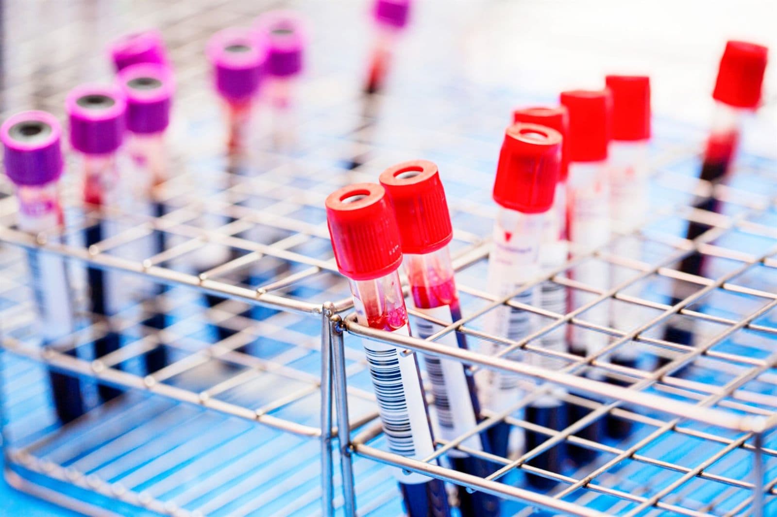 Interpretazione degli esami del sangue incrociando più parametri