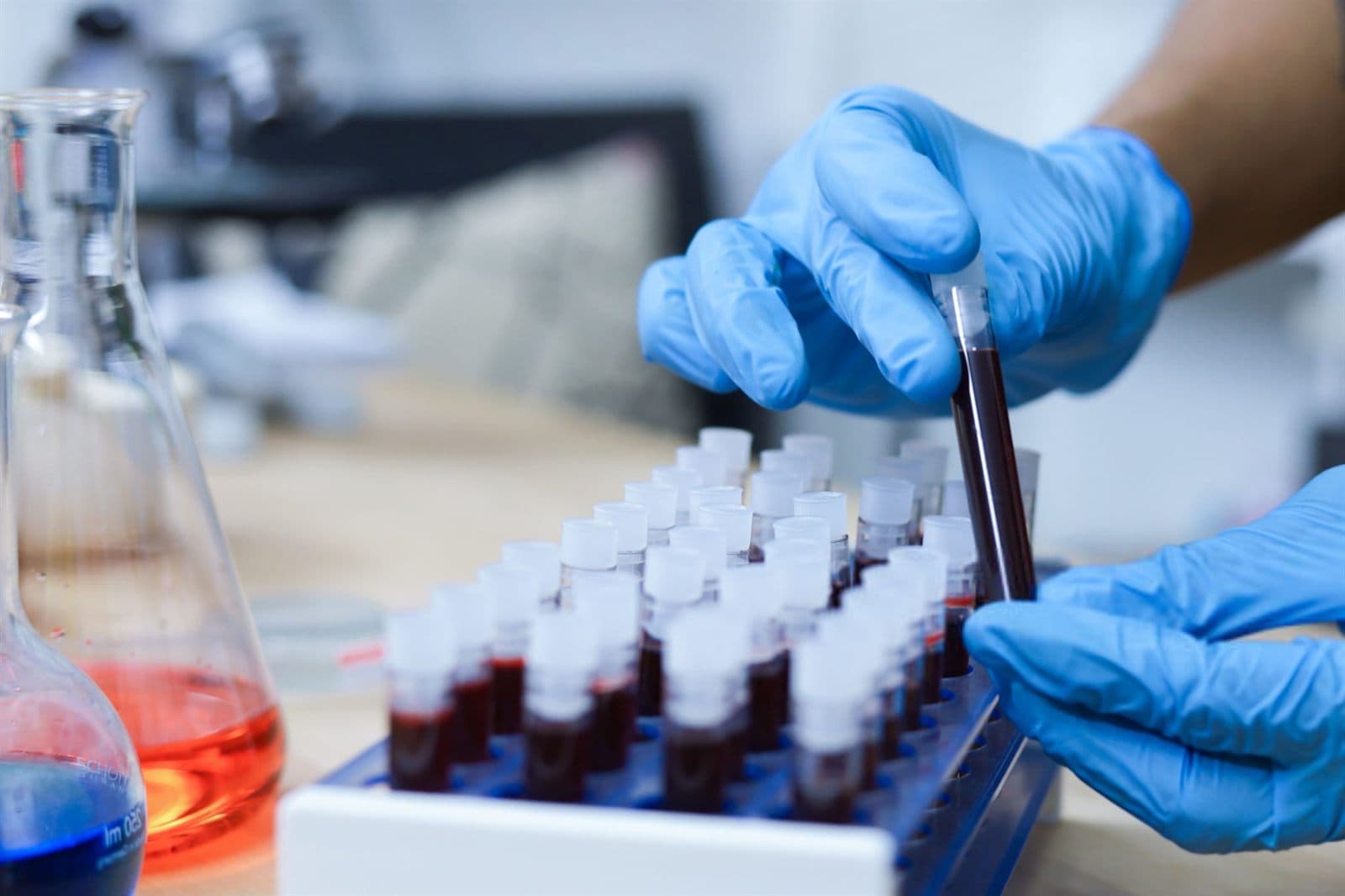 Proteina C reattiva: cosa indica letta nel contesto clinico