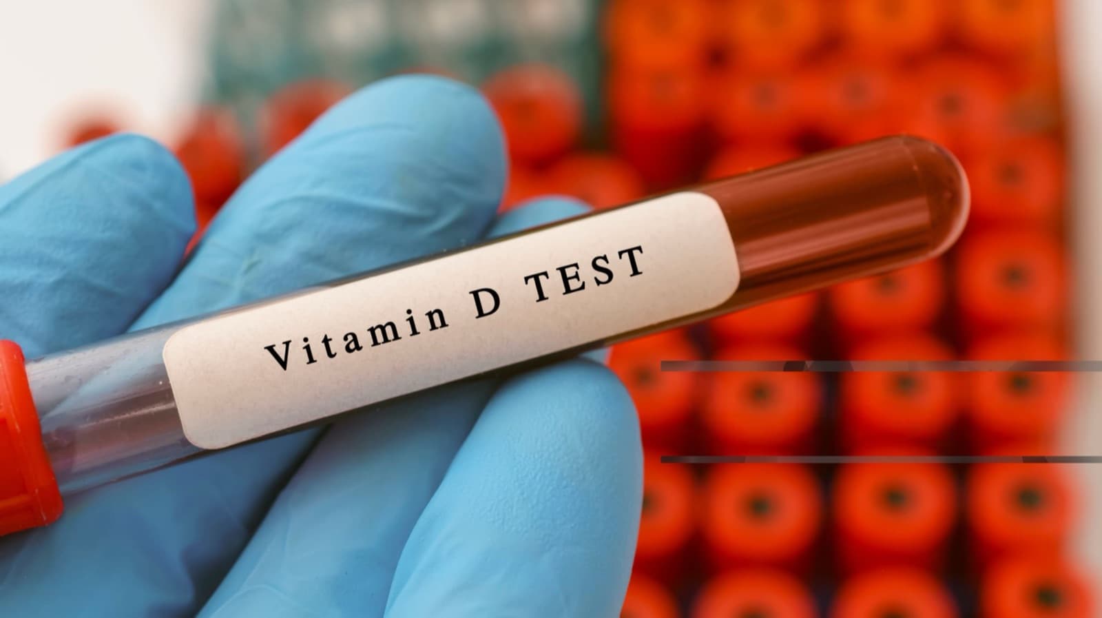 25 oh vitamina d bassa